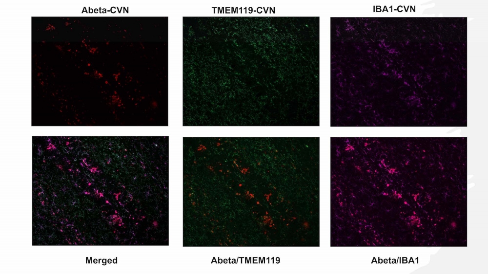 Immunohistochemistry stains of Alzheimer’s plaque and microglia in mouse brains.
