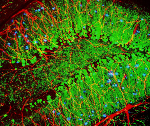 Image: Brain showing hallmarks of Alzheimer’s disease (plaques in blue), by Alvin Gogineni, Genentech, NIH Image Gallery