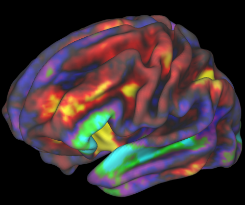 fMRI Image of Preteen Brain.