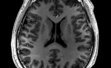Cross-sectional T1-weighted MRI of a healthy human brain produced at a ultra high-field MR of 7 Tesla.